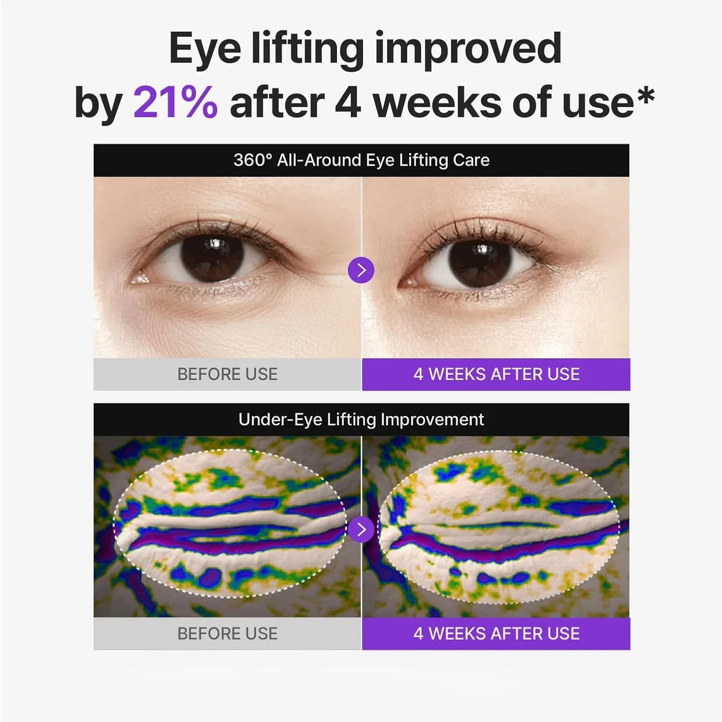 TARESIA 360° PDRN Lifting Eye Cream | Firming & Anti-Wrinkle Under-Eye Treatment (30ml)